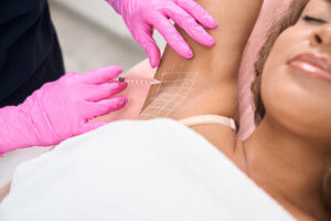 Branding - Med Spa Marketing